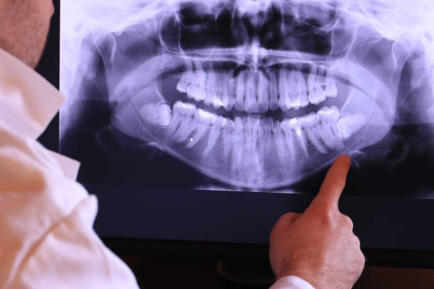 Best Urgent Dental Care for Toothache in Frazier Park, CA