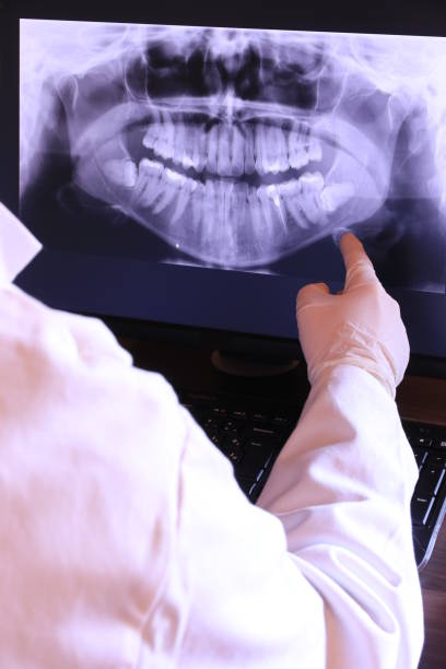 Best Emergency Dental Extractions in Frazier Park, CA